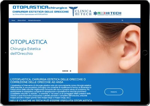 OTOPLASTICA CHIRURGICA — Clinica HiTech