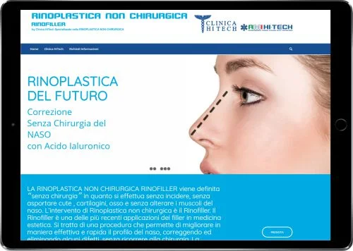 RINOPLASTICA NON CHIRURGICA — Clinica HiTech