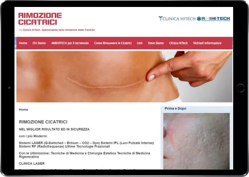 RIMOZIONE CICATRICI — Clinica HiTech