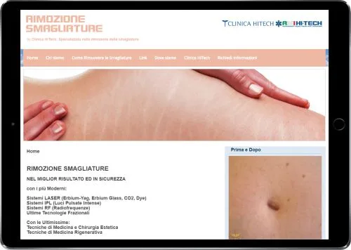 RIMOZIONE SMAGLIATURE — Clinica HiTech