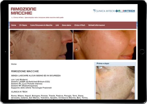 RIMOZIONE MACCHIE CUTANEE — Clinica HiTech