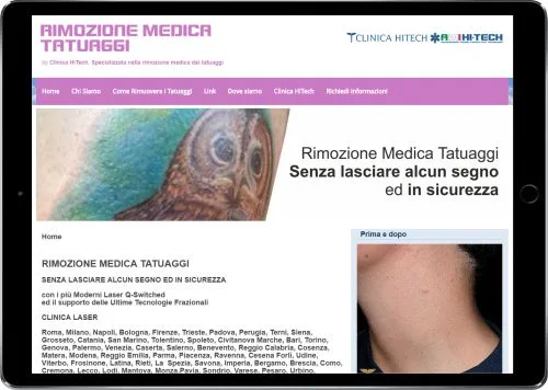 RIMOZIONE MEDICA TATUAGGI — Clinica HiTech