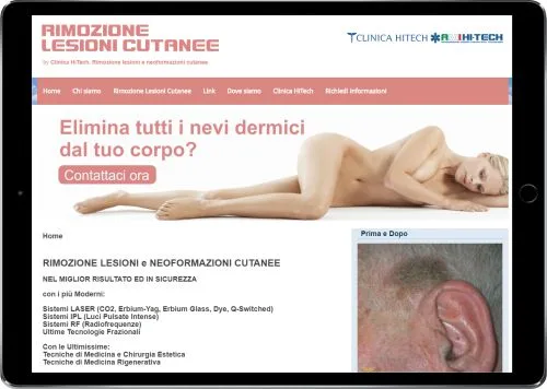 RIMOZIONE LESIONI CUTANEE — Clinica HiTech