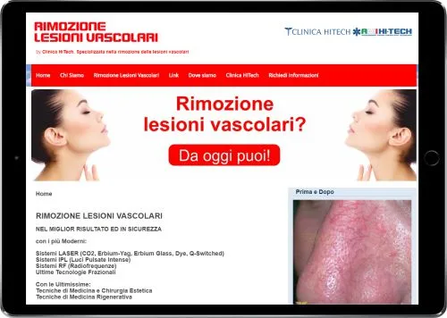 RIMOZIONE LESIONI VASCOLARI — Clinica HiTech