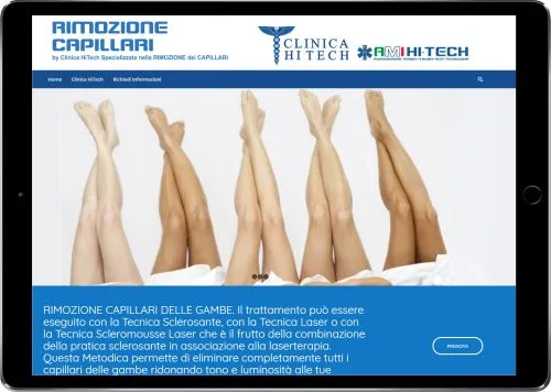 RIMOZIONE CAPILLARI — Clinica HiTech