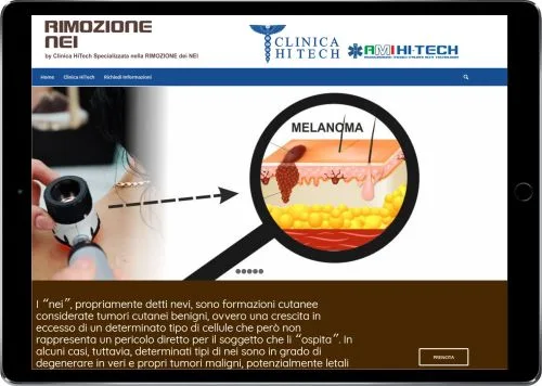 RIMOZIONE NEI — Clinica HiTech