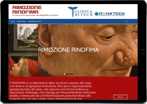 RIMOZIONE RINOFIMA — Clinica HiTech