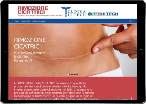 RIMOZIONE CICATRICI — NEW — Clinica HiTech